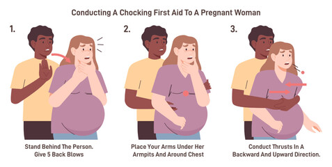Choking first aid for pregnant woman. Heimlich maneuver procedure - obrazy, fototapety, plakaty