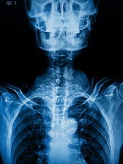 x ray of a human skull