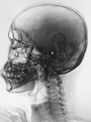 x ray of human skull