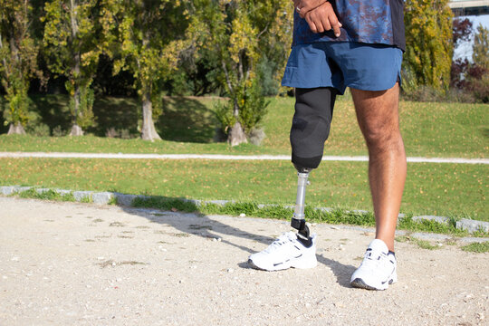 Close-up of Caucasian man with mechanical leg. Sportsman in blue shorts and white sneakers photographed in park. Sport, disability concept