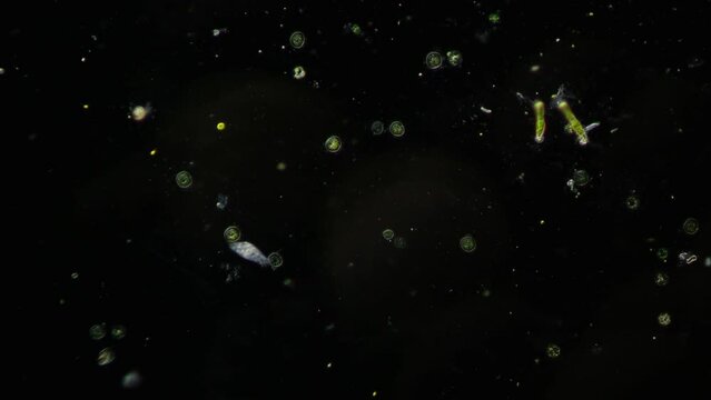 Amoeba and many other microorganisms in the frame. Also in the frame are colonies of unicellular algae and bacteria. Combination of oblique illumination microscopy and darkfield microscopy methods