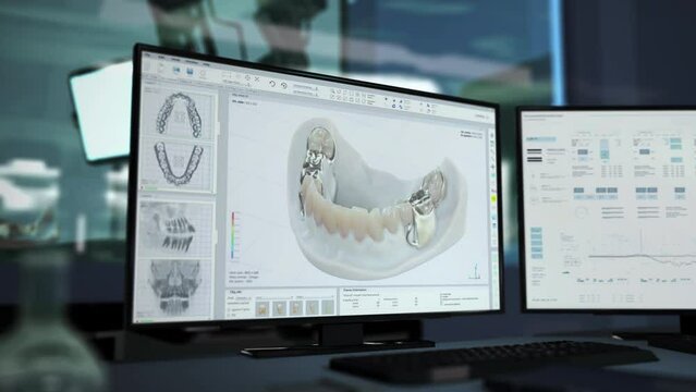 Using futuristic program at the dental clinic. Doctor visualises the denture insertion surgery in computer program at the clinic. Dental clinic program showing the teeth replacement process
