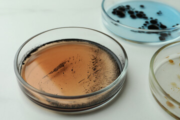Petri dishes with different bacteria colonies on white background, closeup