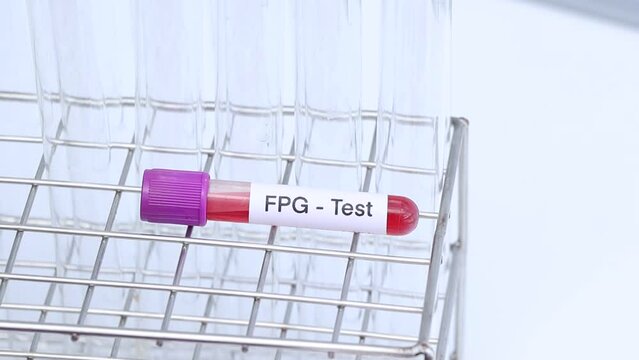 FPG-test from blood , Blood samples to be analyzed in the laboratory, red blood in test tube 