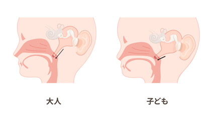 大人と子どもの耳管のイラスト_矢状断