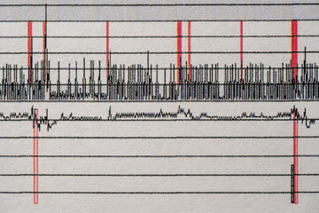 Images charts scientific cardiograms of cardiorespiratory sleep monitoring. Heart pulse or Heart wave, graph on paper. Medical examination cardiogram, closeup