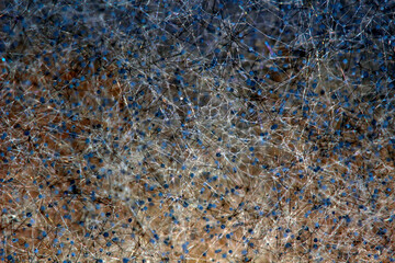 Rhizopus stolonifer or white bread mold, It is found on all types of mouldy materials. Can cause the disease Zygomycosis