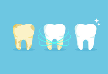 Cleaning teeth. Snow-white and yellow tooth. Before and after whitening. Dental health concept. Vector illustration isolated on blue background