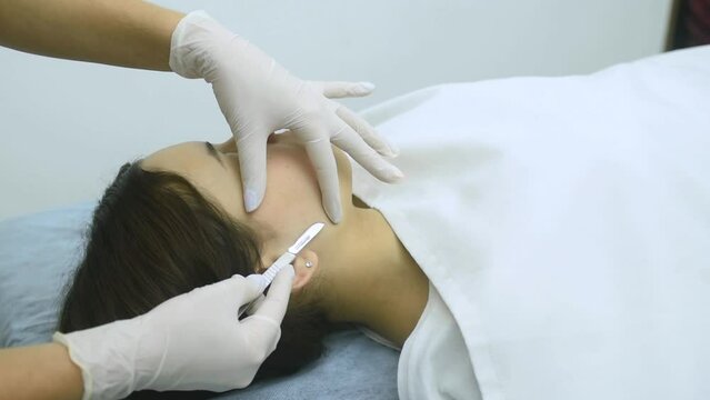 skin treatment with the dermaplaning technique performed with a scalpel by a beautician in a center of aesthetics and beauty of the body and skin