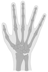 Bones of the right hand, dorsal (posterior) view