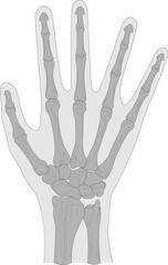 Bones of the right hand, dorsal (posterior) view