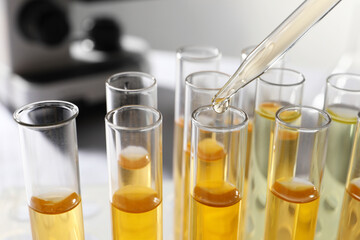 Dropping urine sample for analysis into tube in laboratory, closeup