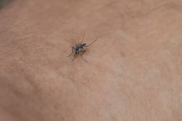 The Aedes albopictus mosquito perches on human skin. Human blood-sucking mosquito