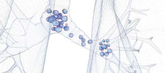 Respiratory syncytial virus (RSV) in the respiratory tract. The RSV virus can cause respiratory infections. 3d illustration.