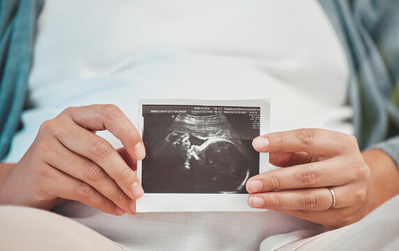 Pregnancy, love and hands with scan of baby with woman excited for future with family, children and kids. Healthcare, newborn baby and hand of pregnant woman with 3d image, ultrasound and photograph