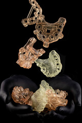 Stomatology. 3d printed model for dentistry. operation templates. Dental Technician. wax print. polymer printing