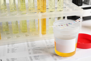 Container with urine sample on table, space for text. Specimen collection