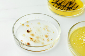 Petri dishes with different bacteria colonies on white background, closeup