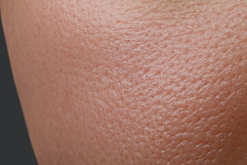 Closeup view of human oily skin as background