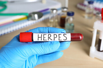 Naklejka premium Doctor in glove holding test tube with word Herpes at wooden table, closeup