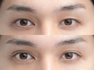 Fototapeta premium 美容整形 イメージ