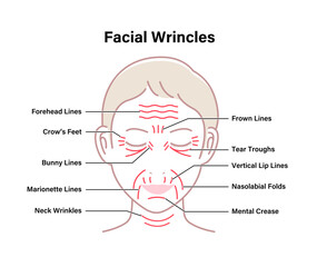 Facial wrinkles ( female face ) vector illustration