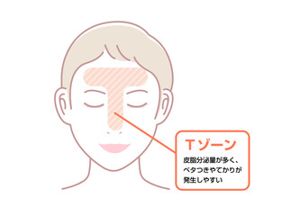 顔の皮脂分泌の多い部位 イラスト (Tゾーン)