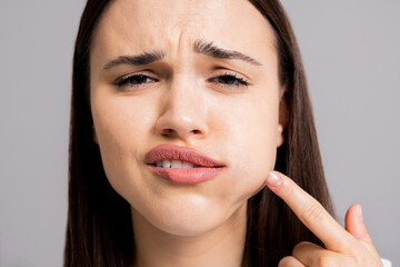 Close up shot on young woman with toothache dental ilnness skhowing painful expressions pointing at swollen mouth.