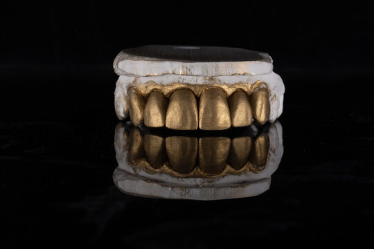 Gold dust on teeth