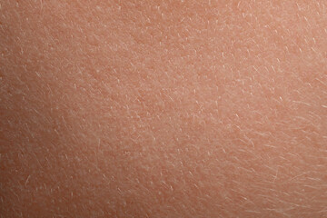 Closeup view of human skin as background