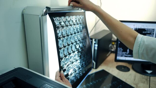 Female hands placing the MRI shot of head on the screen with light. Computer screen with x-ray image at backdrop on the table.