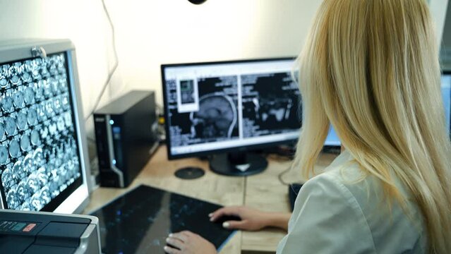 Doctor with long blonde hair wearing white overall looking at the MRI shots of patient’s head. Side view. Computer equipment working at backdrop.