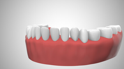 Dental implant in the gum