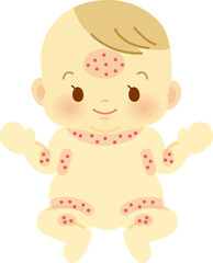 あせもの出来やすい範囲を示した裸姿の赤ちゃん【正面】＿ベビー全身イラスト28(透過背景)
