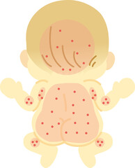 Obraz premium あせもの出来やすい範囲を示した裸姿の赤ちゃん【後ろ】＿ベビー全身イラスト29(透過背景) 