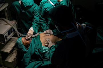 A team of professional doctors perform surgery in a hospital, a group of surgeons working in the operating theater.
