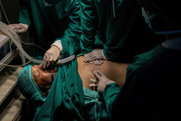 A team of professional doctors perform surgery in a hospital, a group of surgeons working in the operating theater.