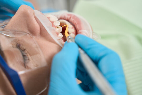Experienced hygienist in nitrile gloves performing dental scaling on client
