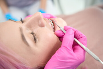 Obraz na płótnie Canvas Orthodontist performs maintenance of bracket system for aligning dentition