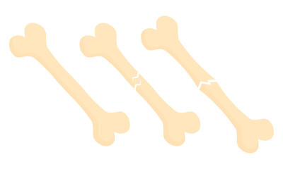 illustration of broken bones and normal bones on a medical theme on a white background