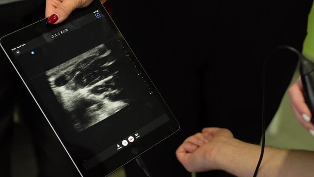 Doctor examines the patient hand with a portable ultrasound scanner. Modern X-ray radiology in healthcare for human diagnostics