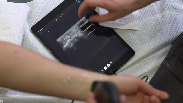 In a hospital, a doctor diagnoses a person arm with a portable x-ray machine. Radiology and tests in a medical institution