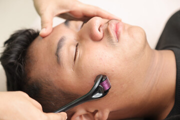 Asian teenage boy doing mesotherapy procedure.  Facial microneedling treatment with a meso roller. ...