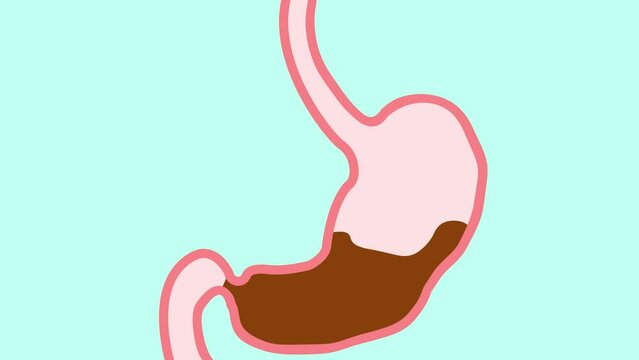 Fluid stomach. Cartoon stomach with poisoning.