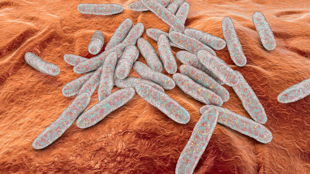 Septisch Bilder Durchsuchen 4,164 Archivfotos, und