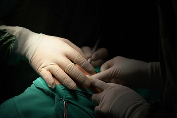 Doctor performing nose surgery in the operating room.  green dresses and black room in the...