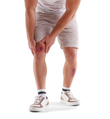 Man with bruises on legs against white background