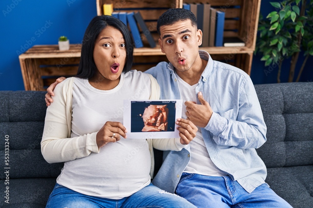 Sticker Young hispanic couple expecting a baby sitting on the sofa showing baby ultrasound scared and amazed with open mouth for surprise, disbelief face