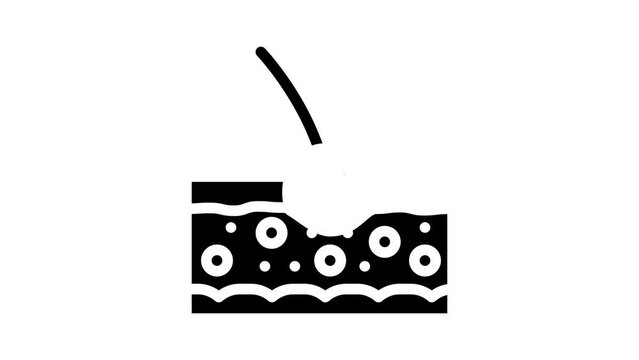 folliculitis skin disease problem glyph icon animation