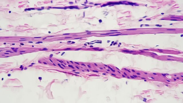 Stratified squamous epithelium in section is filmed under microscope 400x on white background. Macro view of human tissues taken and studied in biological lab with medical equipment. Anatomy theme